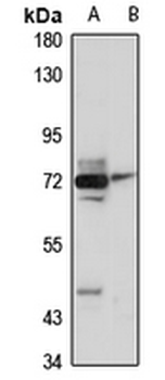 TRIM47 Rabbit Polyclonal Antibody