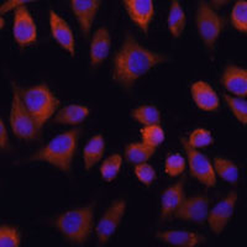 TRIM47 Rabbit Polyclonal Antibody