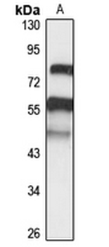 TMPRSS5 Rabbit Polyclonal Antibody