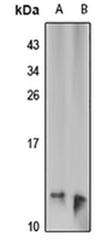 Tim9 Rabbit Polyclonal Antibody