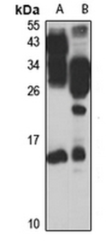 TIAF1 Rabbit Polyclonal Antibody