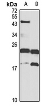 TAF9 Rabbit Polyclonal Antibody