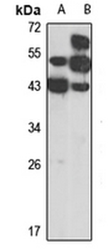 SYCE1 Rabbit Polyclonal Antibody