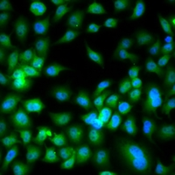 SYCE1 Rabbit Polyclonal Antibody