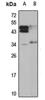 STK16 Rabbit Polyclonal Antibody