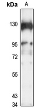SNX25 Rabbit Polyclonal Antibody