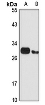 SNRPB Rabbit Polyclonal Antibody
