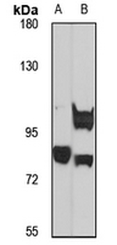 SNRK Rabbit Polyclonal Antibody