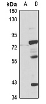 ZIP4 Rabbit Polyclonal Antibody