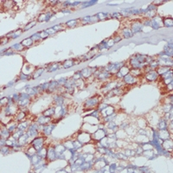 ZIP4 Rabbit Polyclonal Antibody