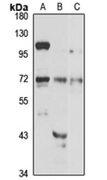 SLC27A1 Rabbit Polyclonal Antibody