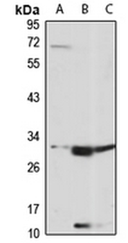 SLC25A22 Rabbit Polyclonal Antibody