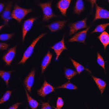 SLC25A22 Rabbit Polyclonal Antibody