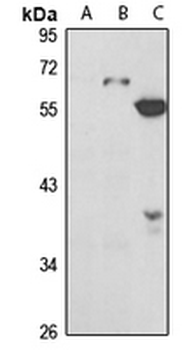 Serpin D1 Rabbit Polyclonal Antibody