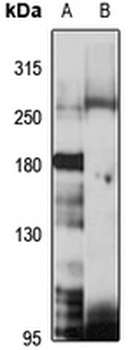 SCN7A Rabbit Polyclonal Antibody