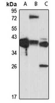 SCN4B Rabbit Polyclonal Antibody