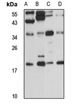 RSPH9 Rabbit Polyclonal Antibody