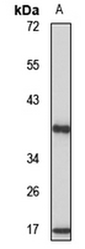 RPP38 Rabbit Polyclonal Antibody