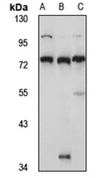RNF220 Rabbit Polyclonal Antibody