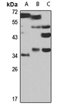 RNF212 Rabbit Polyclonal Antibody