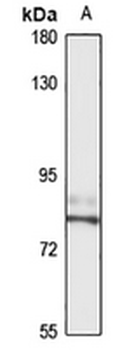 RFX2 Rabbit Polyclonal Antibody