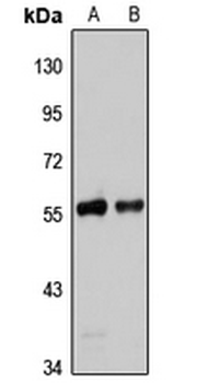 REXO4 Rabbit Polyclonal Antibody