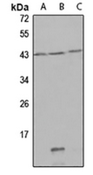 QPCT Rabbit Polyclonal Antibody