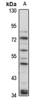 PTH2R Rabbit Polyclonal Antibody