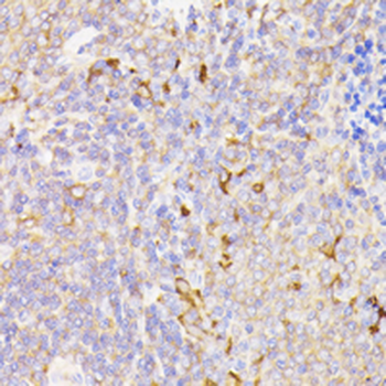 PSMG1 Rabbit Polyclonal Antibody
