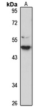 PRR11 Rabbit Polyclonal Antibody