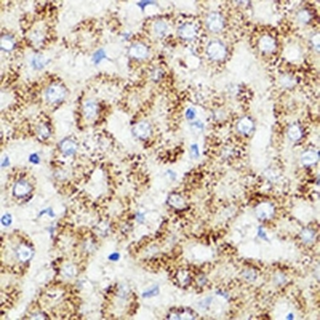 PRR11 Rabbit Polyclonal Antibody
