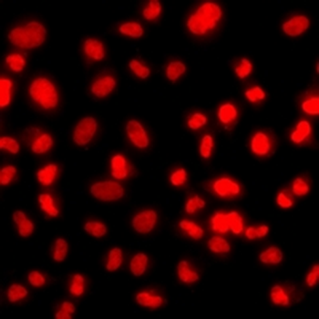 PRICKLE2 Rabbit Polyclonal Antibody