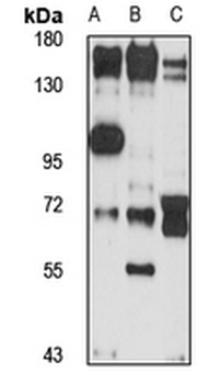 PP6R3 Rabbit Polyclonal Antibody