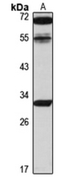 PP2C-eta Rabbit Polyclonal Antibody