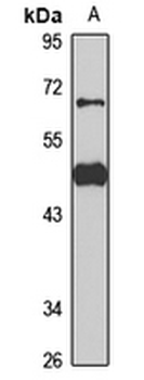 WDR51B Rabbit Polyclonal Antibody