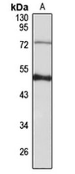 PKNOX1 Rabbit Polyclonal Antibody