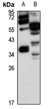 PEX16 Rabbit Polyclonal Antibody