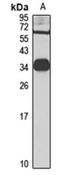 PECR Rabbit Polyclonal Antibody