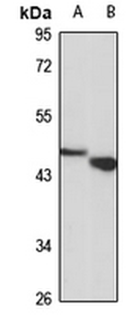 PBX3 Rabbit Polyclonal Antibody