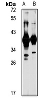 OTUD6A Rabbit Polyclonal Antibody