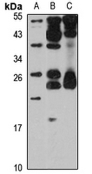 OSTF1 Rabbit Polyclonal Antibody