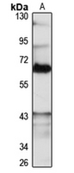 NOC4L Rabbit Polyclonal Antibody