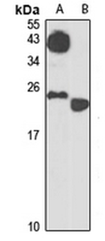 Bex3 Rabbit Polyclonal Antibody