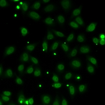 Bex3 Rabbit Polyclonal Antibody