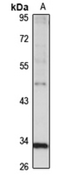 AADACL1 Rabbit Polyclonal Antibody