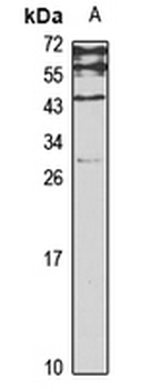MAD Rabbit Polyclonal Antibody