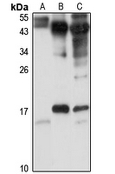 MRP-S14 Rabbit Polyclonal Antibody