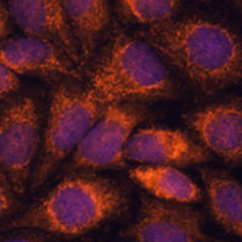 MRP-S14 Rabbit Polyclonal Antibody