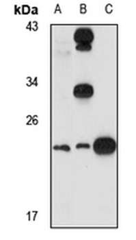 MIXL Rabbit Polyclonal Antibody