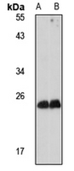 MED20 Rabbit Polyclonal Antibody